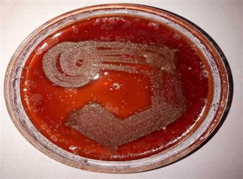 1 Hemolysis On Blood Agar Download Scientific Diagram