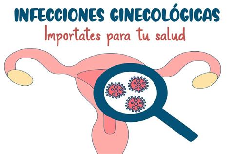 Infecciones Ginecológicas Candidiasis Vaginal