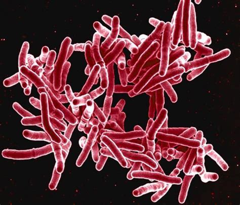 Mycobacterium Tuberculosis Tricks Body Into Autoimmunity Immunopaedia