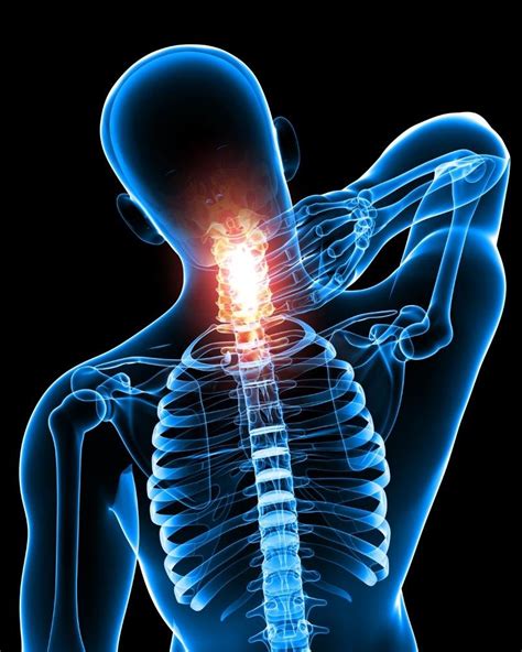Effective Neck Pain Treatment And Relief Fsap Care