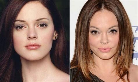 Rose Mcgowan Before And After Plastic Surgery 12 Celebrity Plastic Surgery Online