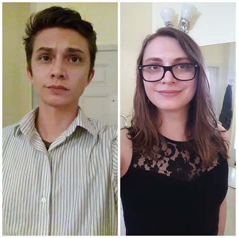 Before And After 2 Years Of Hrt Rlgbt