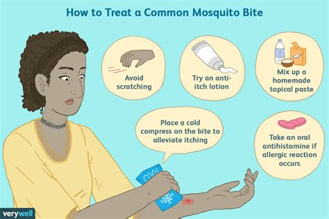 Giant Mosquito Bite Deals Discounts Save 55 Jlcatjgobmx