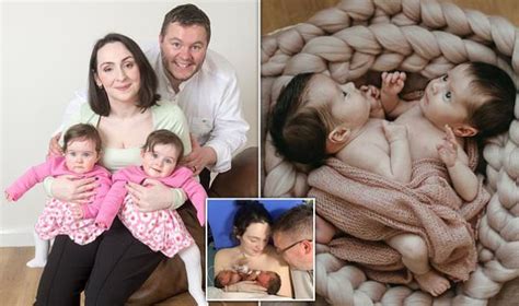 Conjoined Twins Thriving After 18 Hours Of Surgery To Separate Them