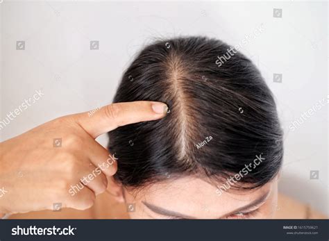 Women Thin Hair There Pulses Hair Stock Photo Edit Now 1615759621