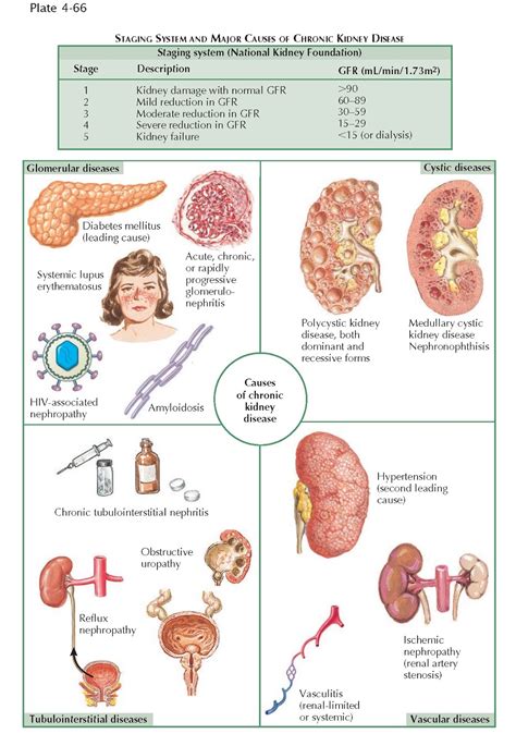 Overview Of Chronic Kidney Disease Pediagenosis