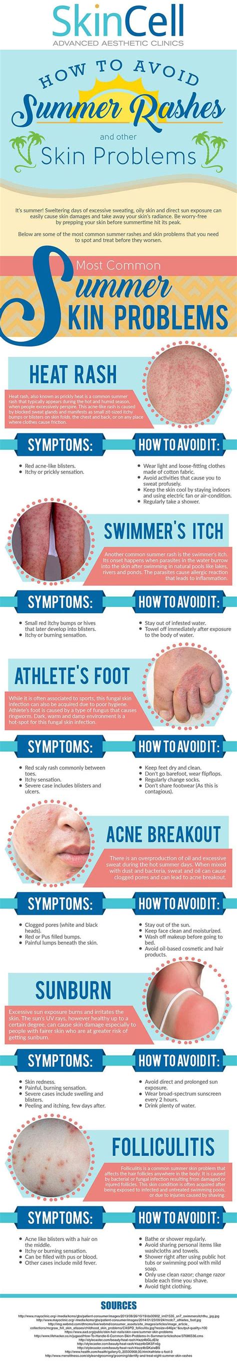 How To Avoid Summer Rashes And Other Skin Problems Ucollect Infographics