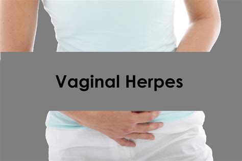 Natural Treatment Of Herpes Blog