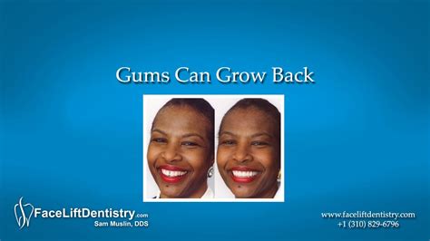 Gums Can Grow Back Youtube