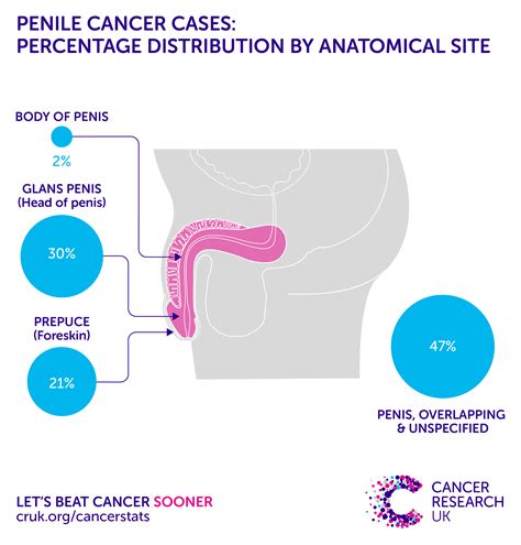 Penile Cancer Incidence Statistics Cancer Research Uk