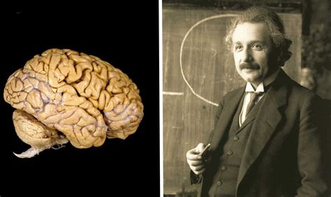 La Muerte De Un Genio Y Su Cerebro Albert Einstein El Almacen Del