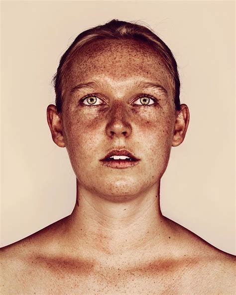 Photographer Takes Portraits Of Freckled People To Celebrate Their Unique Beauty Portrait