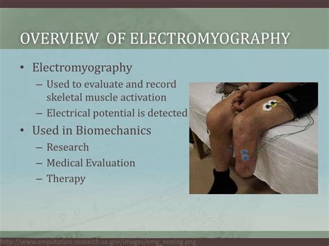 Ppt Electromyography Powerpoint Presentation Free Download Id2068783