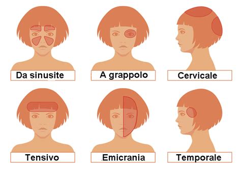 Cambio Di Stagione Sconfiggi La Cefalea