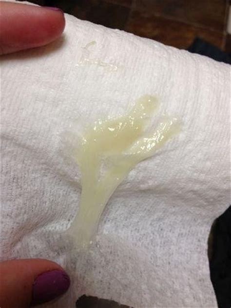 It is starting to appear that you disrespect us bu. Yellow Cervical Mucus Pregnant