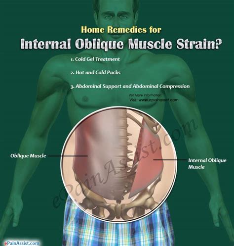 Home Remedies And Exercises For Internal Oblique Muscle Strain