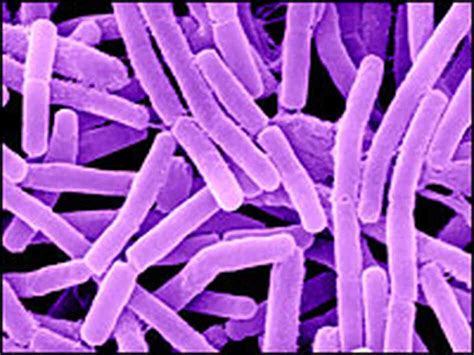 Qanda What You Should Know About Anthrax Npr