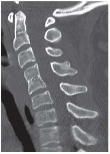 Spine Radiology Key