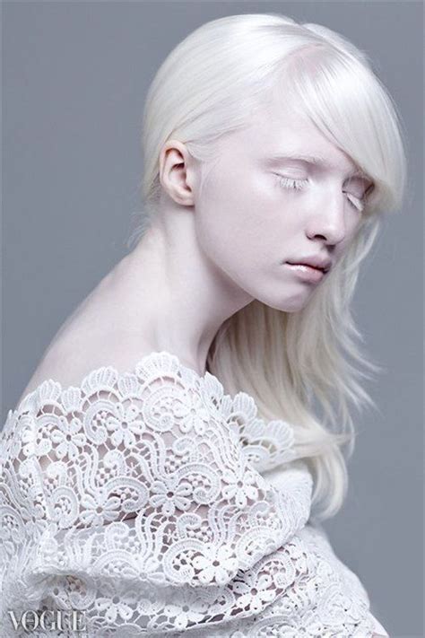17 Best Images About Albinism On Pinterest Models