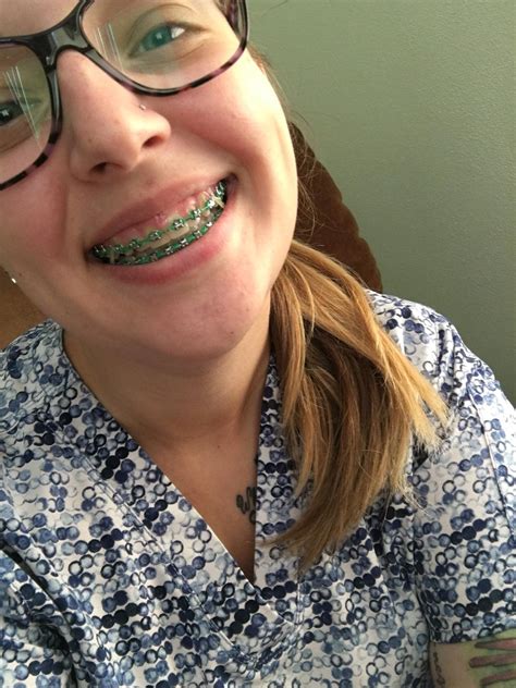 This Is The Face Of A Girl Who Gets Her Braces Off In A Month Last Color Is Green For The Green