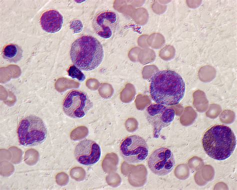 Bone Marrow Blood Cells Light Micrograph Stock Image C0463690