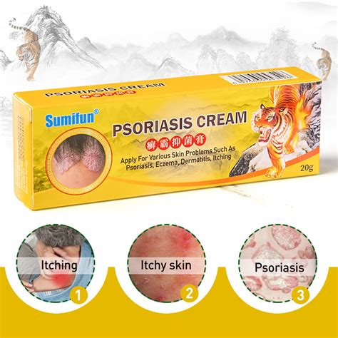 Sumifun 20g Psoriasis Cream Chinese Dermatitis Eczema Ointment Pruritus