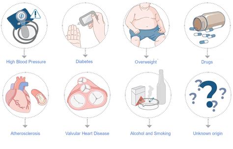 Therapy And Ablation For Atrial Fibrillation Irregular Heartbeat