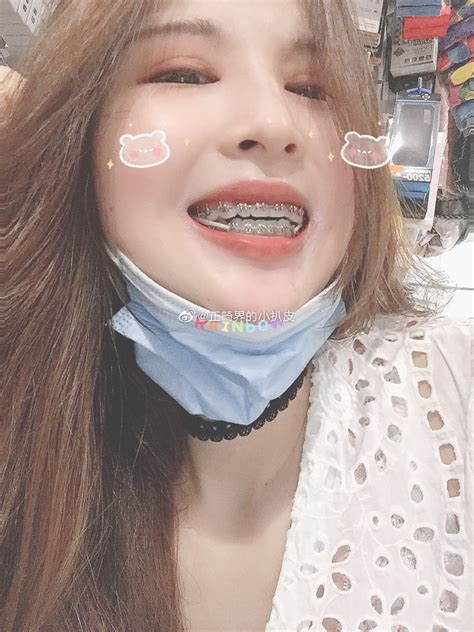 Pin By Shrood Burgos On Braces Braces Tips Braces Girls Cute Braces