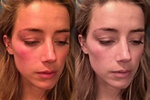 Amber Heard Accused of Editing Injury Photos by Johnny Depp's Lawyer