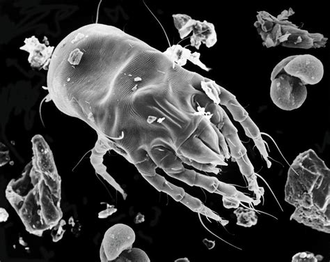 Dust Mite Dermatophagoides Pteronyssinus Photograph By Dennis Kunkel
