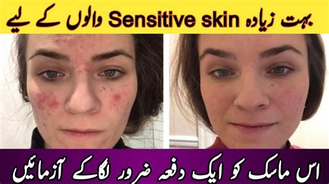Sensitive Skin Care Home Remedies Sensitive Skin Care Face Mask