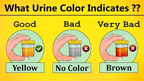 What The Urine Color States About Your Health Urine Infection