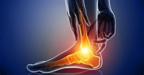 Foot Nerve Disorders Ankle Medstar Health