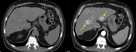 A general surgeon does not necessarily mean you need surgery, but their training makes them experts in abd pains. CT - Radiology at St. Vincent's University Hospital