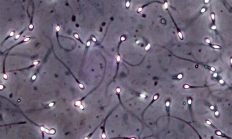 Study Turns Skin Tissue From Infertile Men Into Early Stage Sperm Cells Science The Guardian