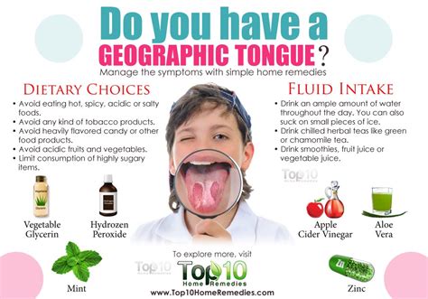 Home Remedies For Geographic Tongue