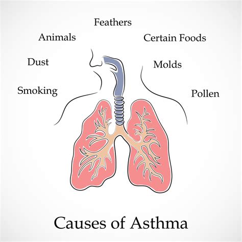 Asthma Diagnosis Net Health Book