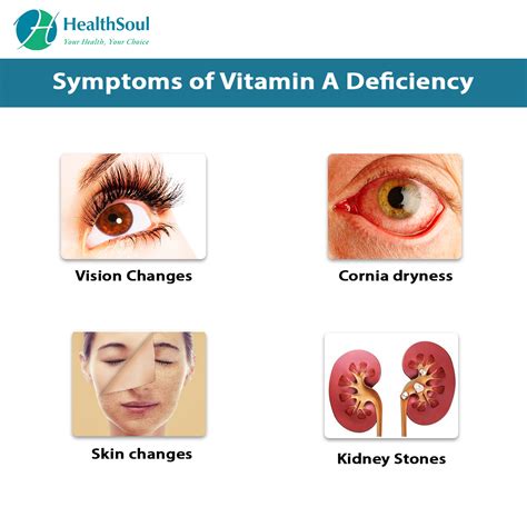 Vitamin A Deficiency Causes Symptoms And Treatment Bio Time Inc