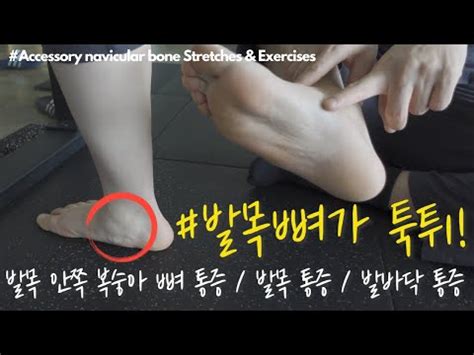 Best Accessory Navicular Bone Stretches Exercises Youtube