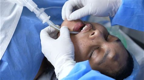 Doctor Women To Anesthesia Intubation For Small Hemangioma Surgery