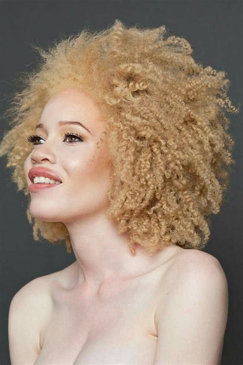 The Beauty Of The White Ebony Albino Everyevery