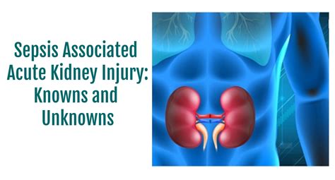 Sepsis Associated Acute Kidney Injury Knowns And Unknowns Sepsis