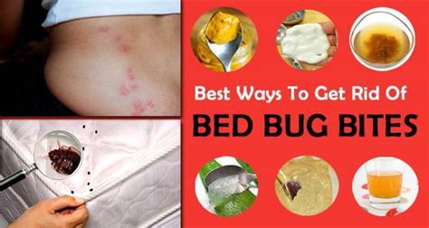 Not all people are bitten by fleas, but should you be so unlucky, then i have some advice for you on how to get rid of the flea bites. How To Get Rid of Bug Bites Scars - Home Remedies Ways ...