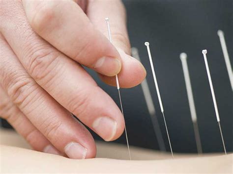The Power Of Needles In Acupuncture Gravitythailand