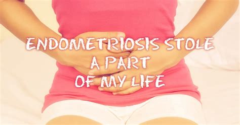 Endometriosis Stole A Part Of My Life Cureup
