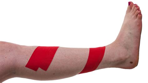 Taping For Shin Splints Physical Sports First Aid Blog