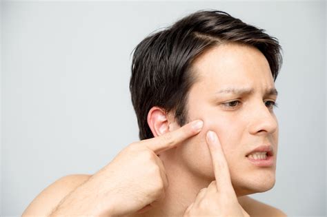 How To Pop Pimples Properly Oxygenetix