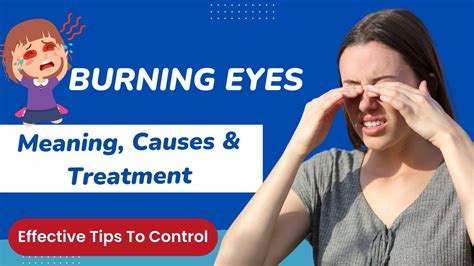 Burning Eyes Meaning Causes And Treatment Treatment Of Burning Eye