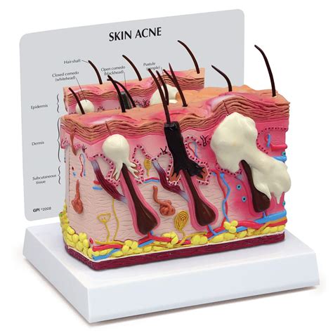 Buy Gpi Anatomicals Skin Acne Model Cross Section Model Showing