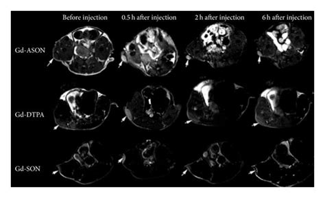 T1 Weighted Multiple Slice Multiple Echo Weighted MRI Of Nude Mice